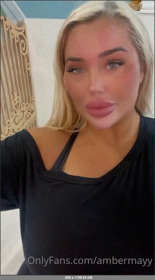 MEGA-FANS – ambermayy-23-09-2021-Had 6ml in my face and Botox