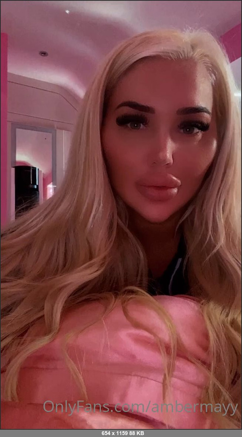 MEGA-FANS – ambermayy-25-09-2021-How good does my face look after 6ml of fillers and Botox  no makeup